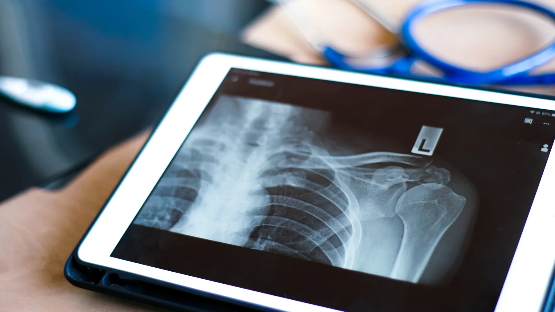X-Ray service